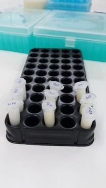 Pesquisa da UEM mostra que obesidade reduz nutrientes do leite materno