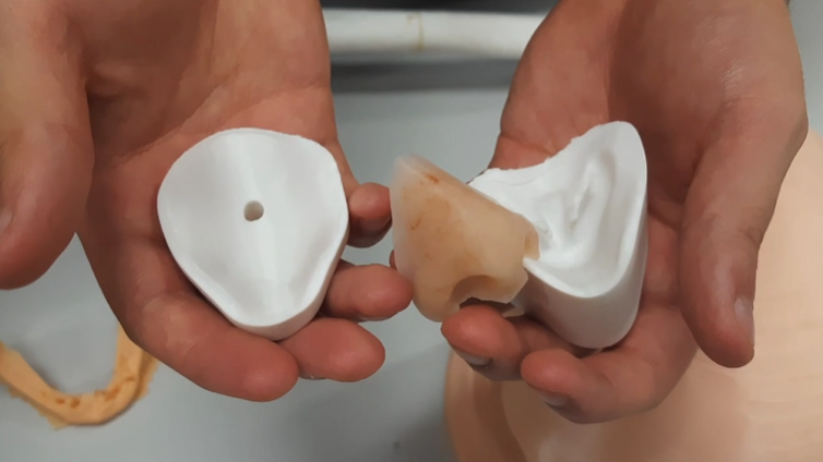 Regenera prótese facial