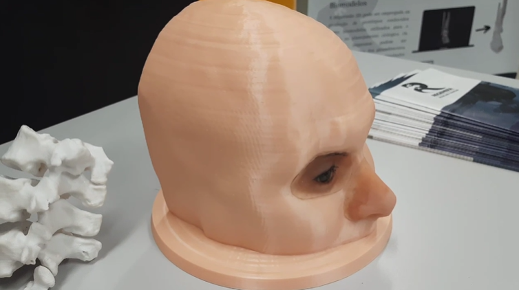 Regenera prótese facial