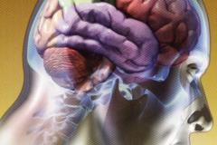 cerebro