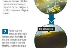 celulatronco
