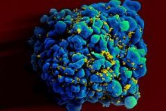HIV
